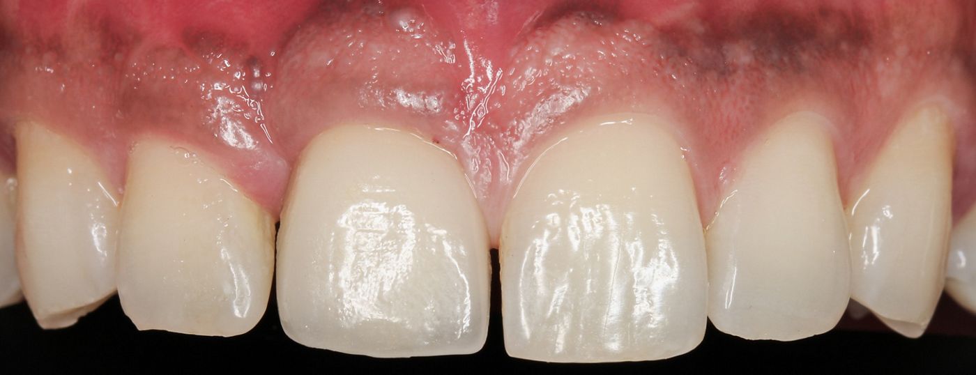 fig. 11