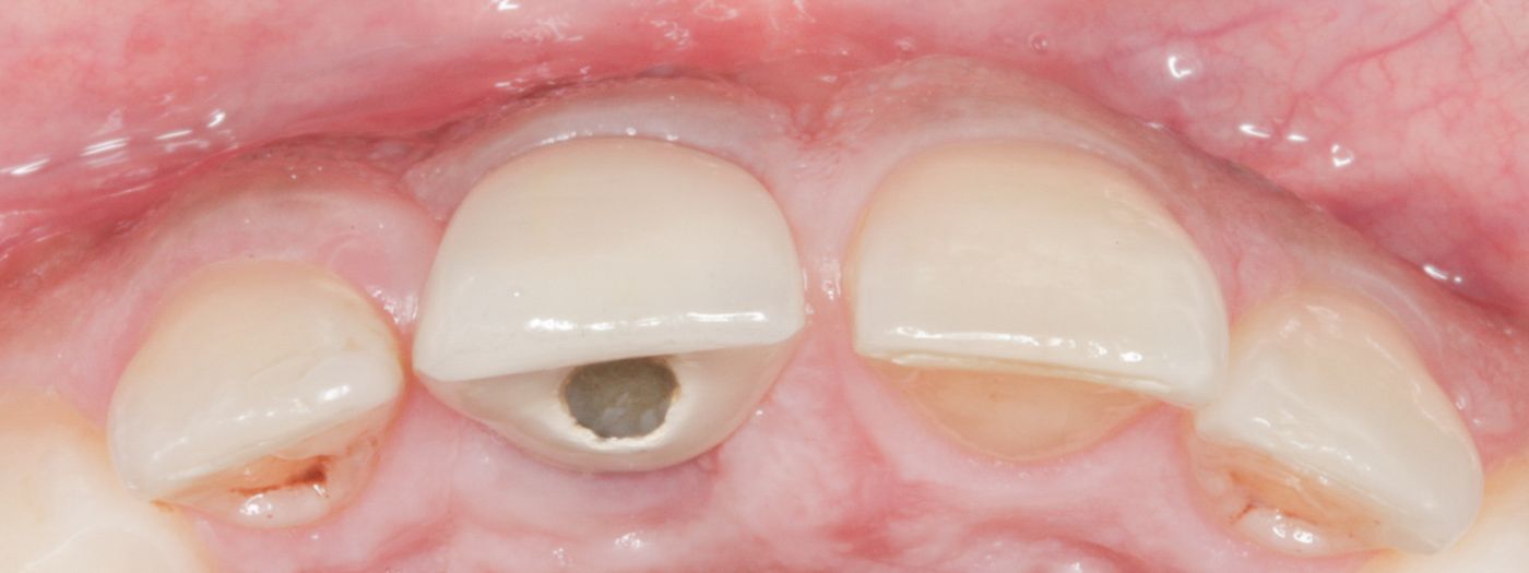 fig. 12b