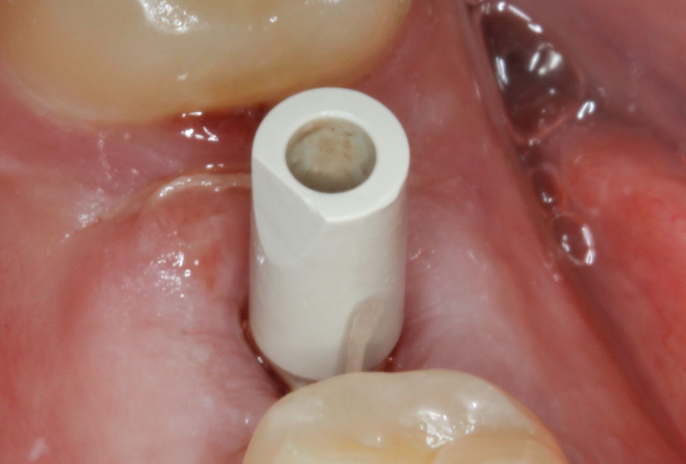 fig. 22