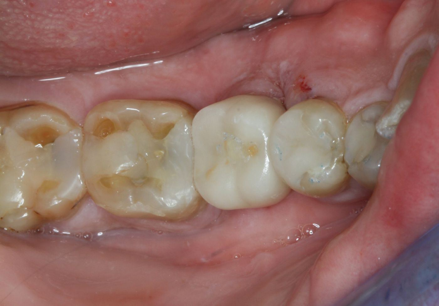 fig. 24