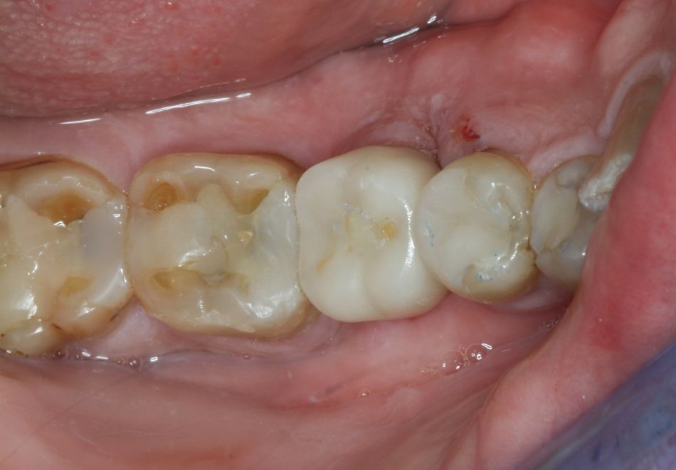 fig. 24