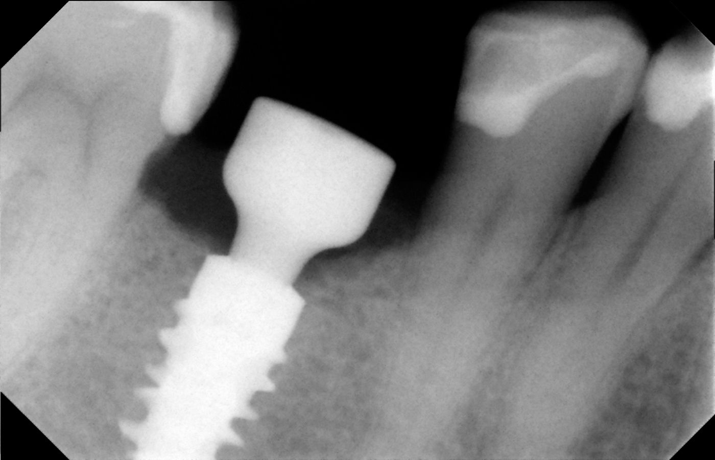 fig. 26