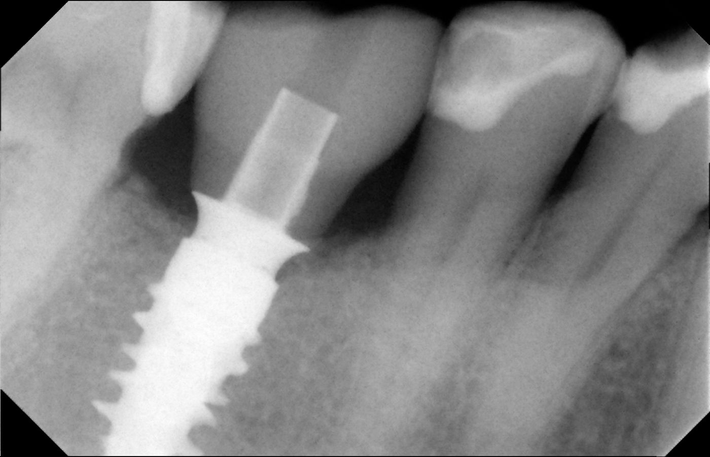 fig. 27