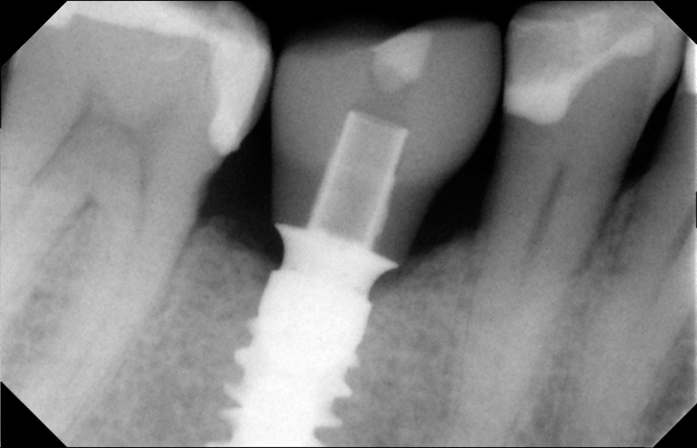 fig. 28