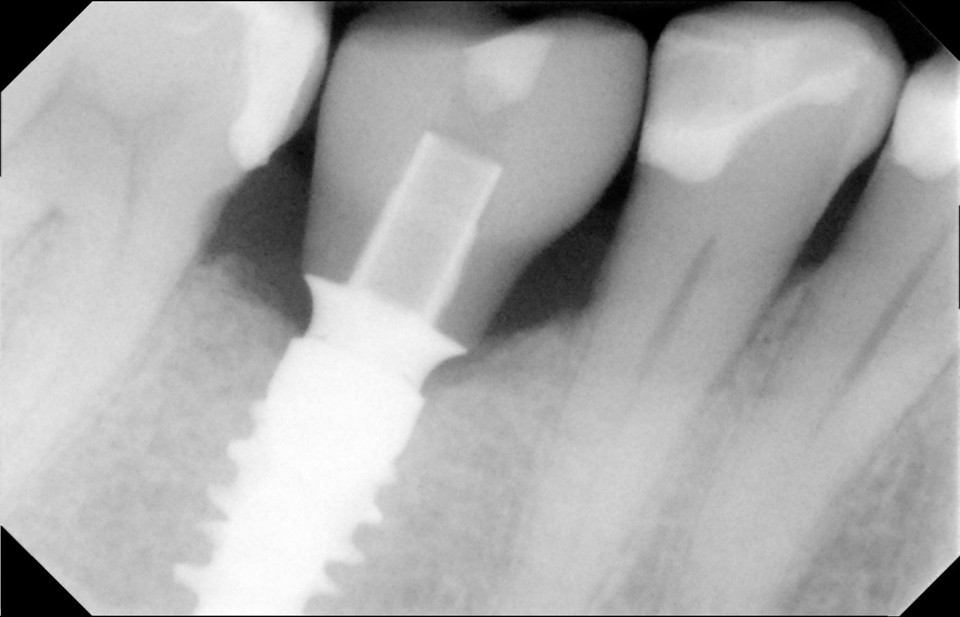 fig. 29