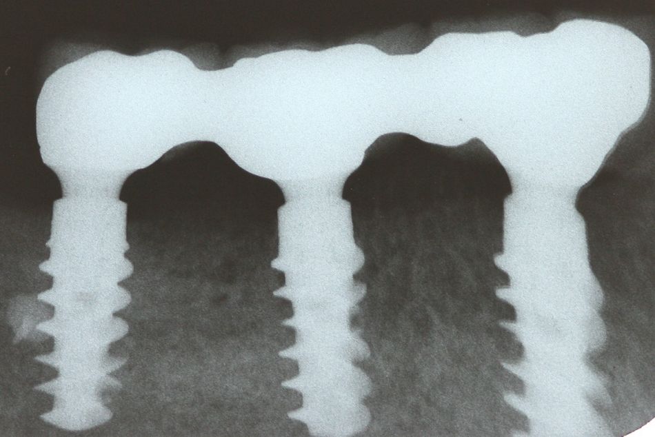 fig. 29