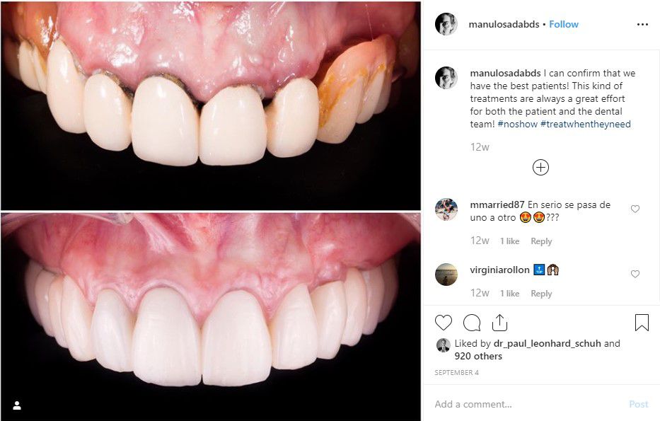 Dr. Manu Losada features before and after shots on his Instagram to show patients what’s possible and get them excited about what their smile could look like, too. 