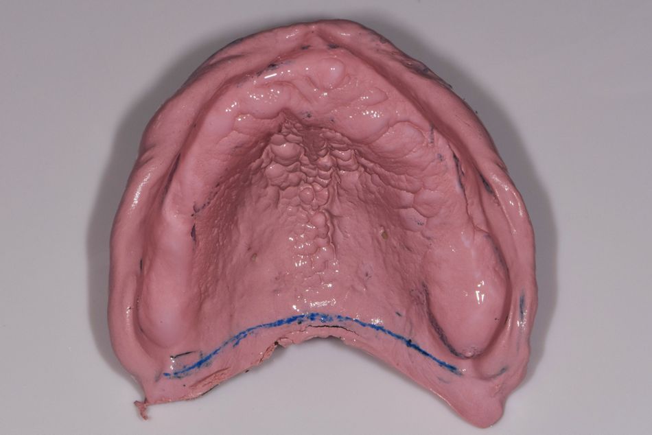 fig. 5a