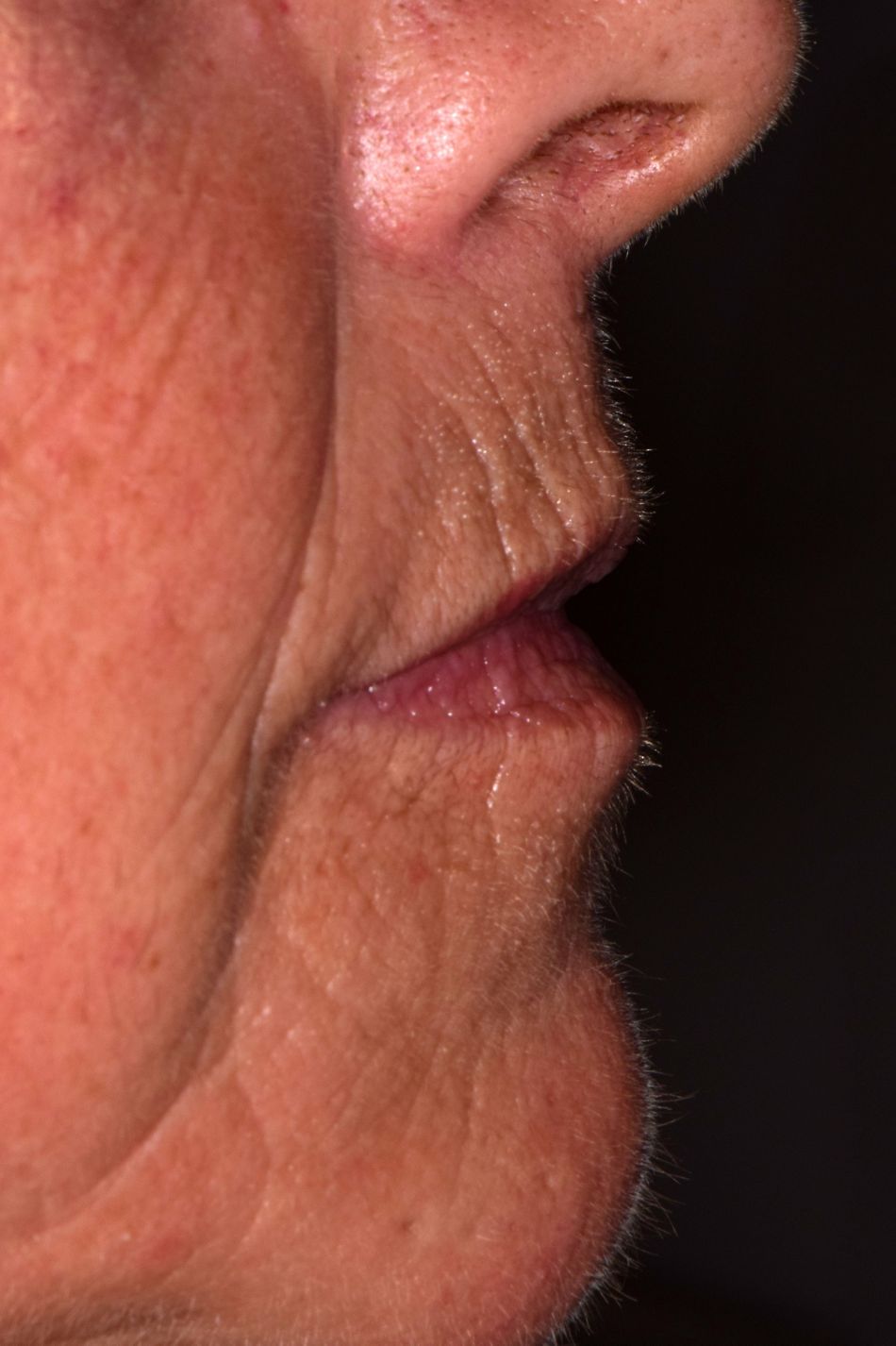 fig. 7b