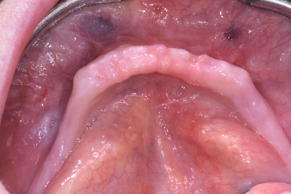fig. 1a