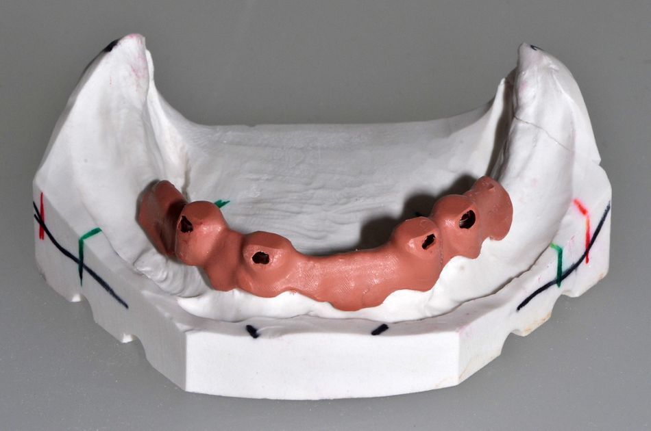 fig. 10a