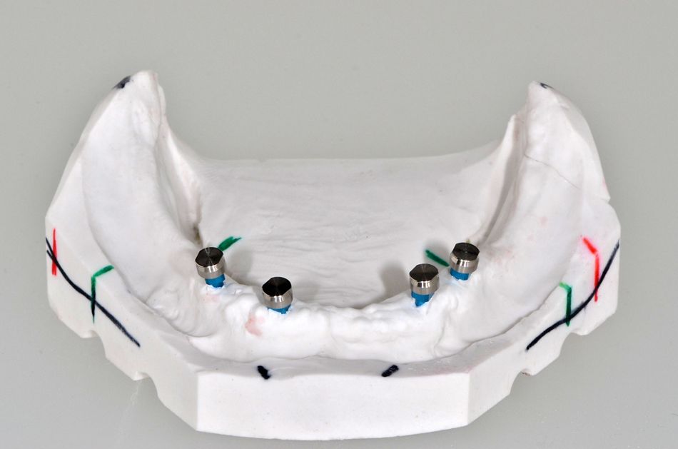 fig. 11a