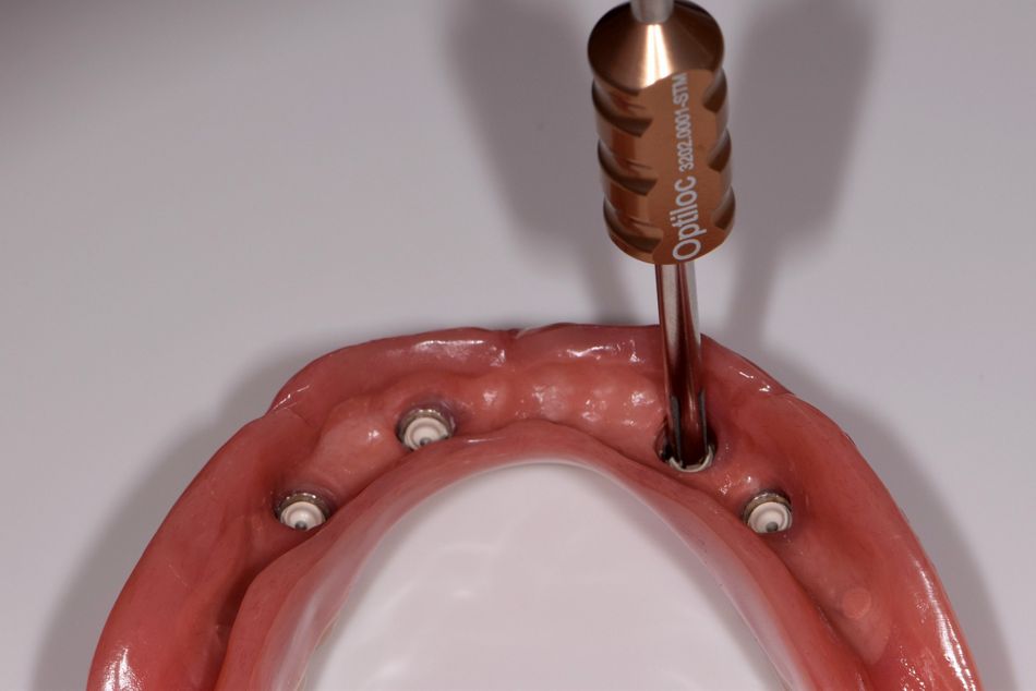 fig. 12b