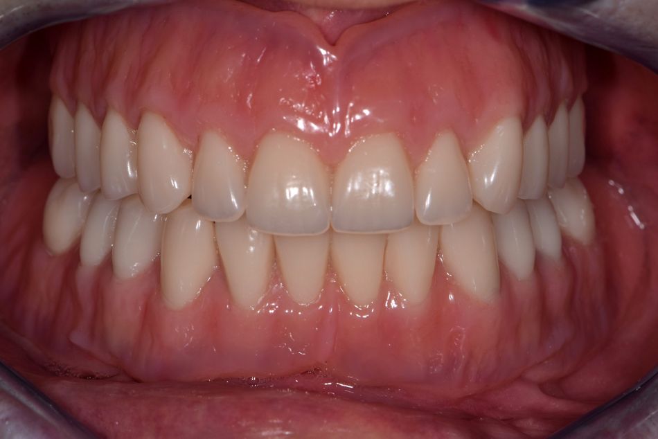 fig. 14a