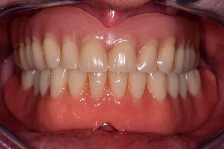 fig. 1b