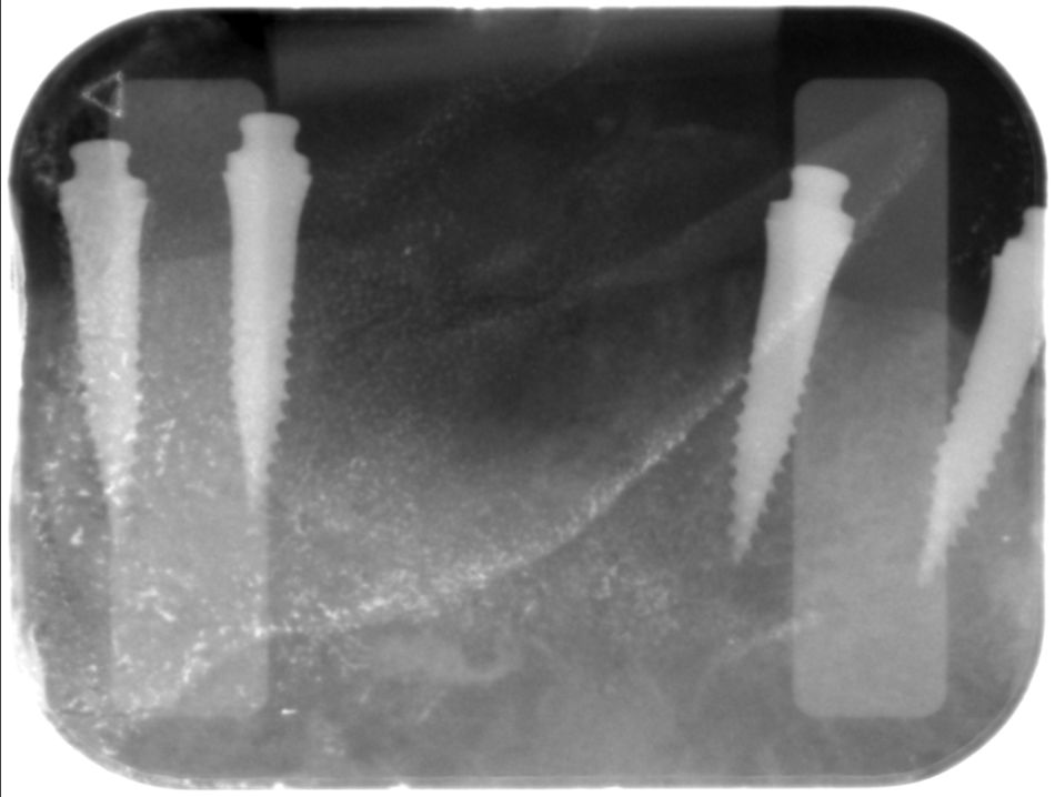 fig. 4c
