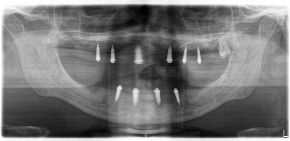 fig. 36
