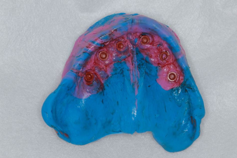 fig. 43