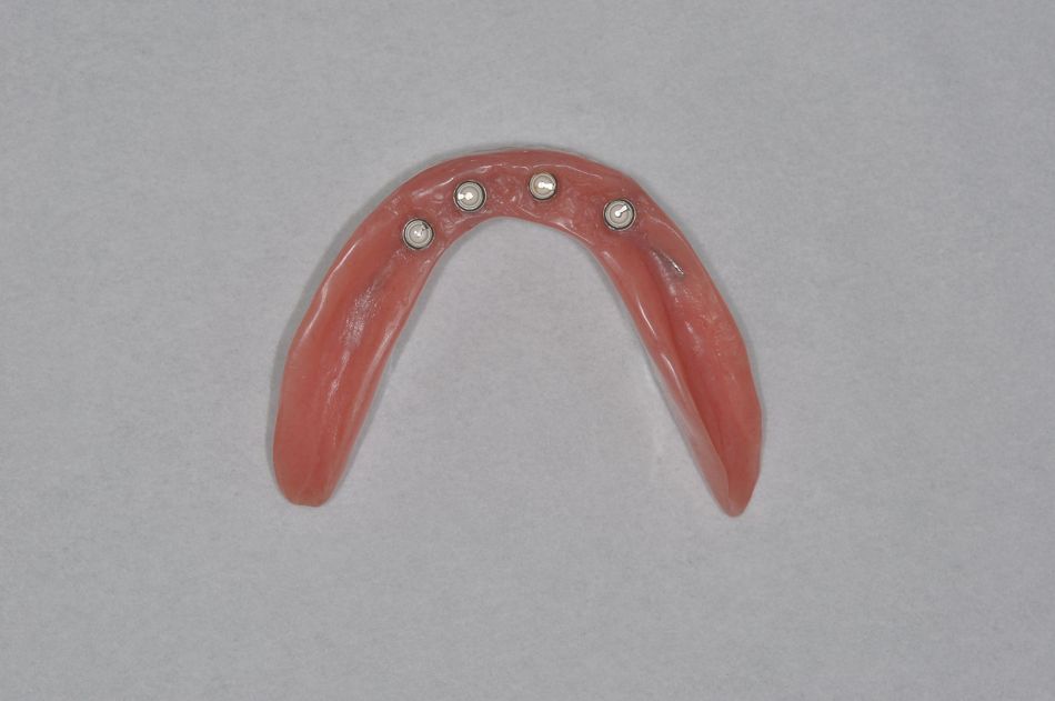 fig. 53