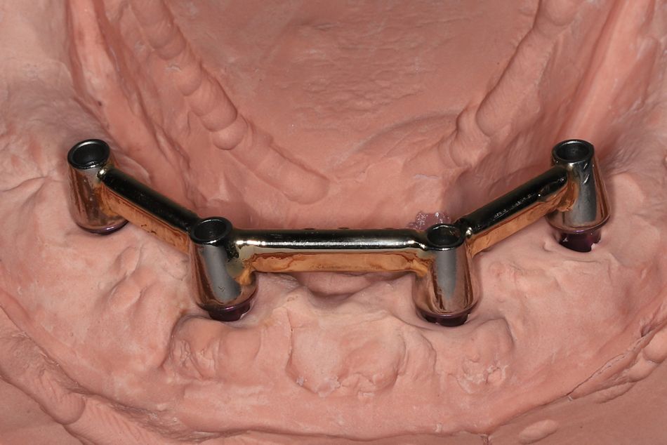 fig. 12