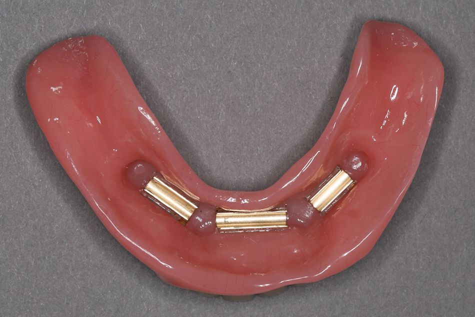 fig. 13
