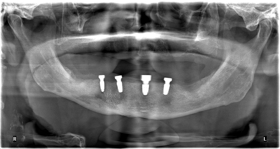 fig. 5