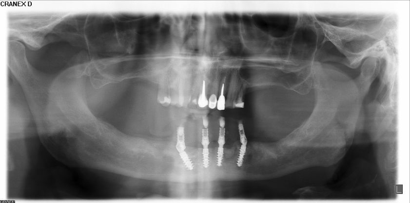 fig. 36
