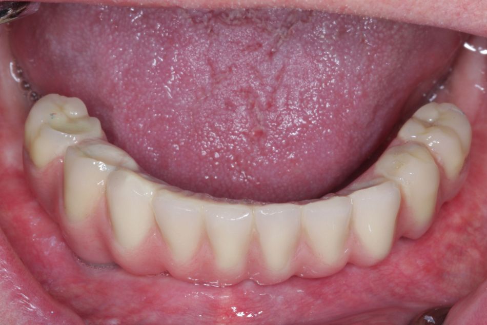 fig. 38