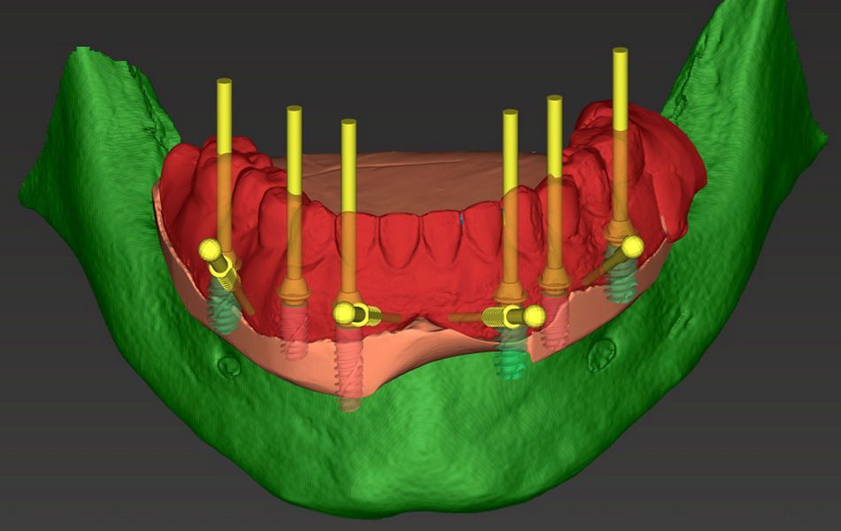 fig. 5