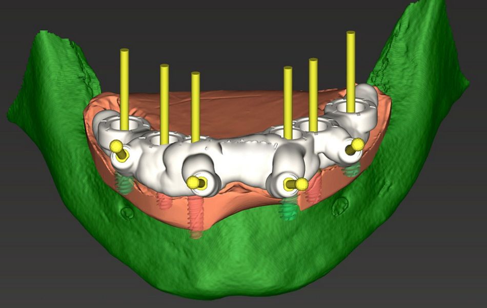 fig. 6