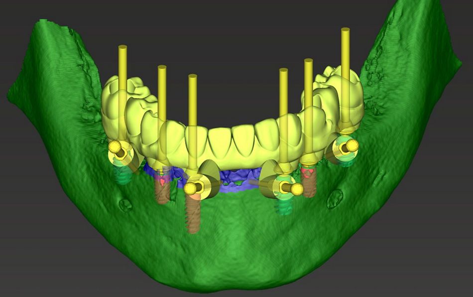 fig. 10