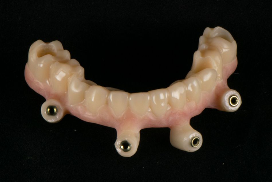 fig. 11