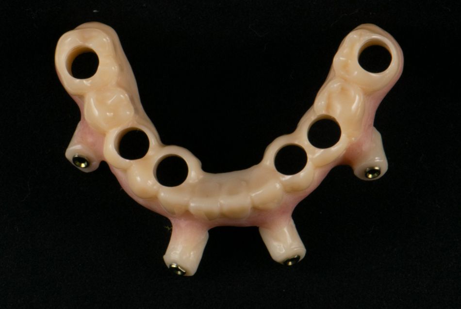 fig. 12