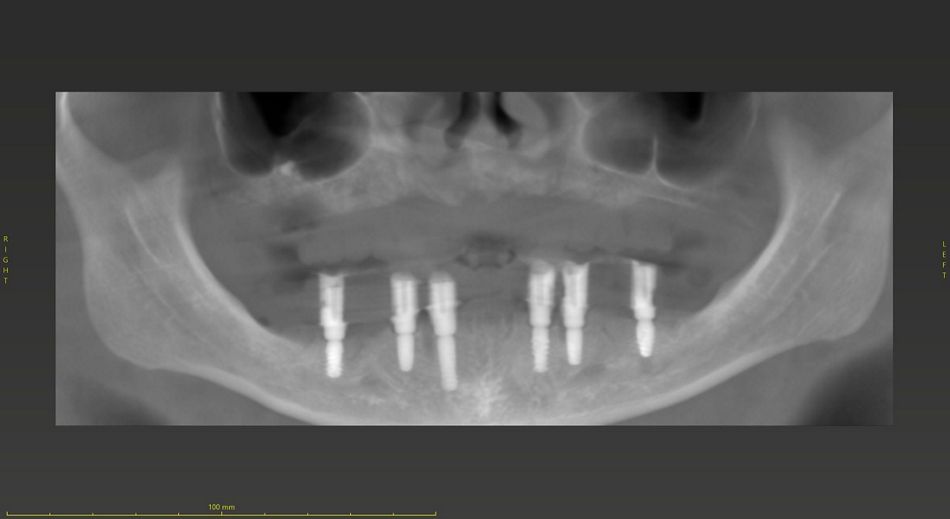 fig. 24