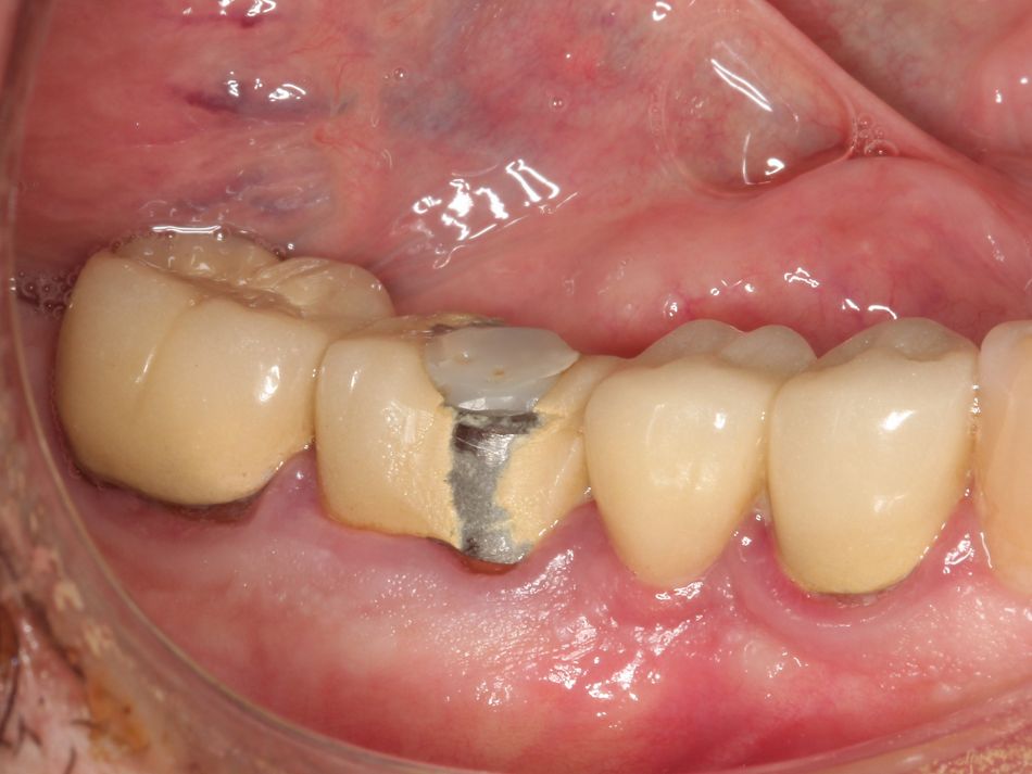Fig. 2a Preoperative view