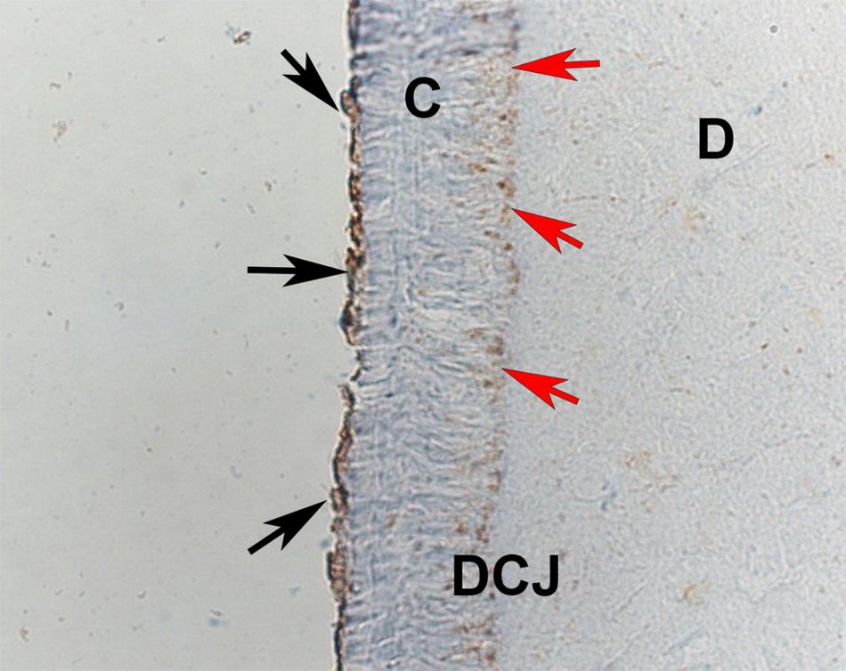 Histological section depicting enamel matrix proteins localized at the dentino-cemental junction (DCJ).