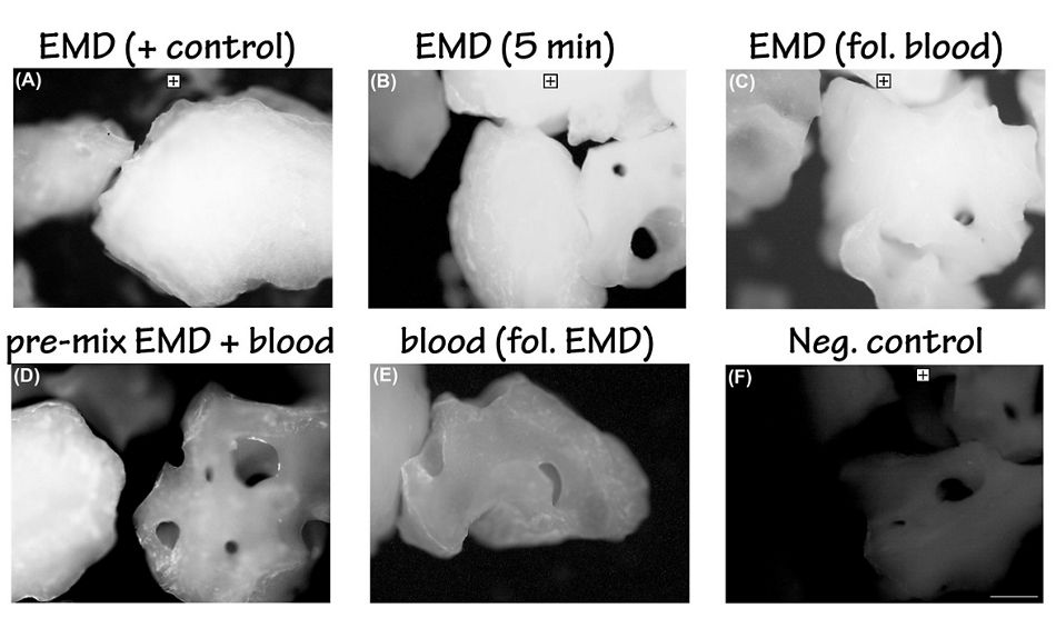 Anti-EMD fluorescent labeling for EMD coated onto NBM particles in the presence or absence of blood.