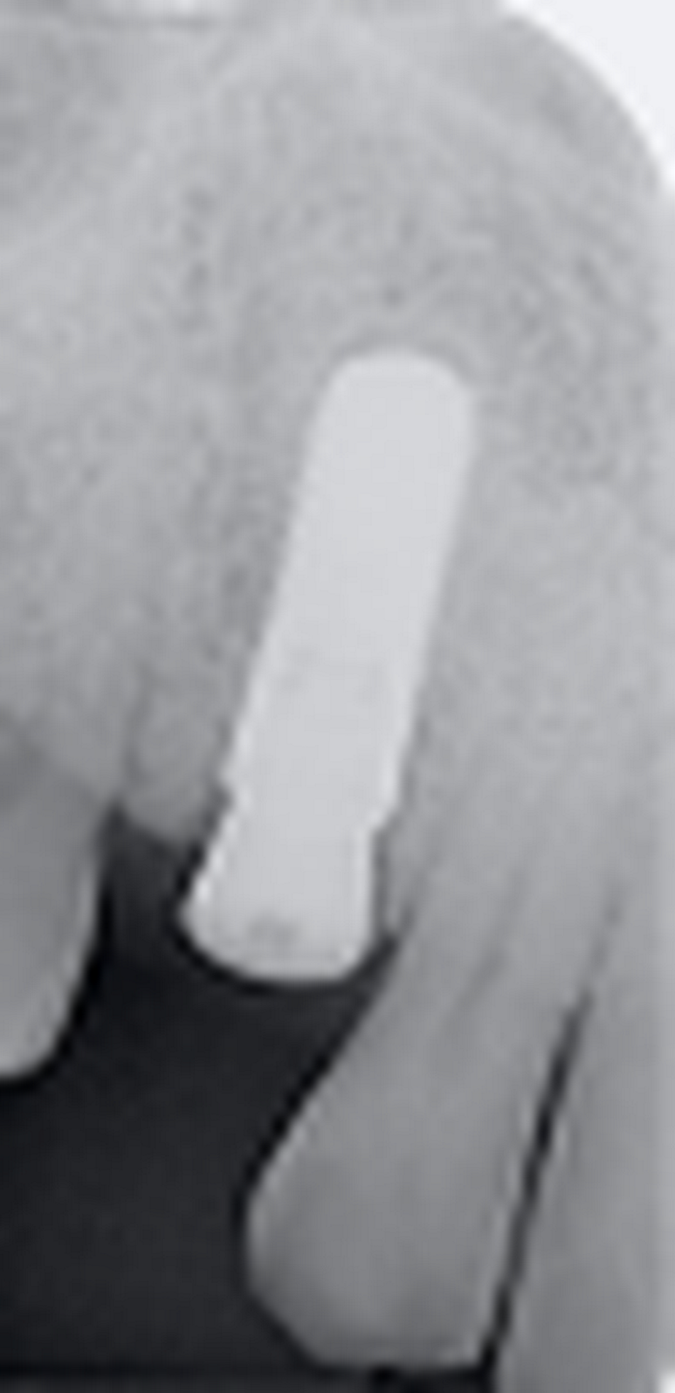 fig. 13