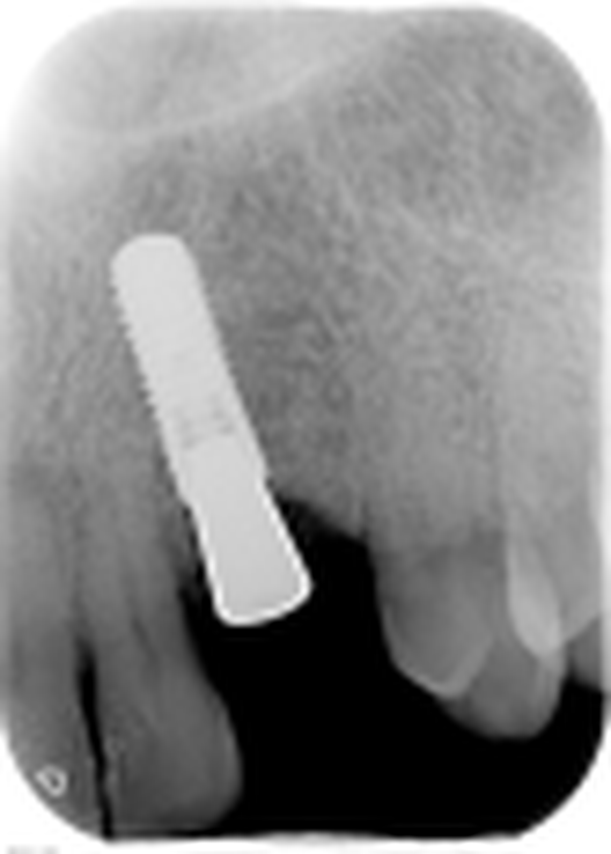 fig. 14
