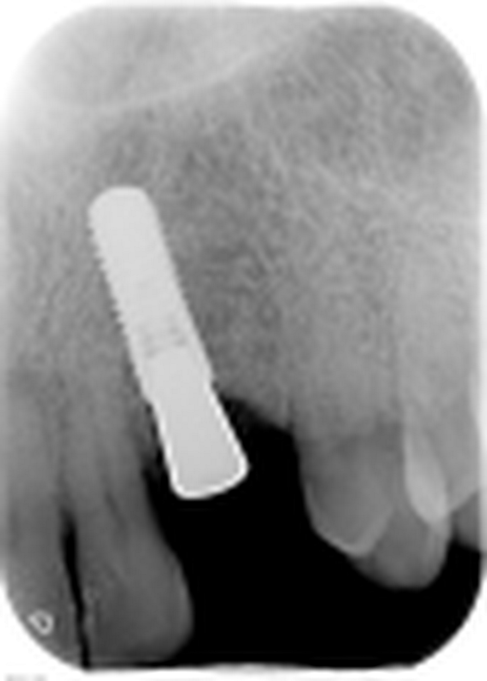 fig. 14