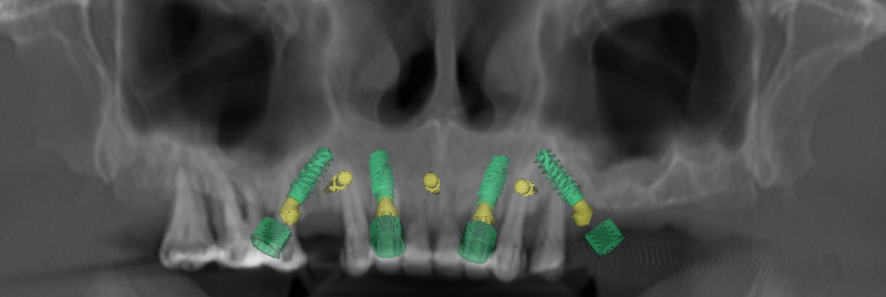 fig. 9