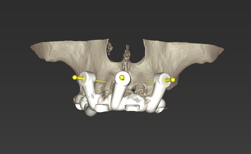 fig. 10