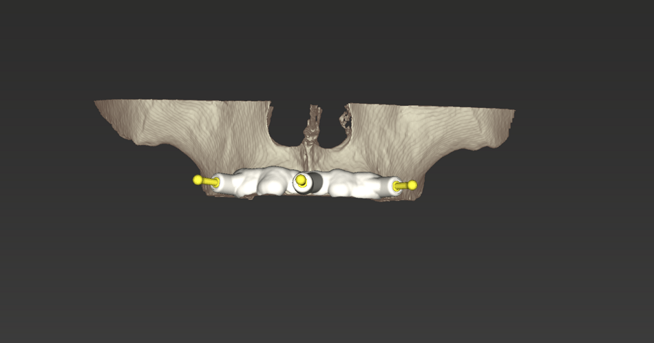 fig. 11