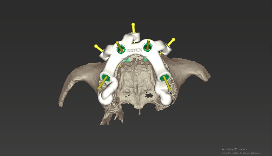 fig. 12