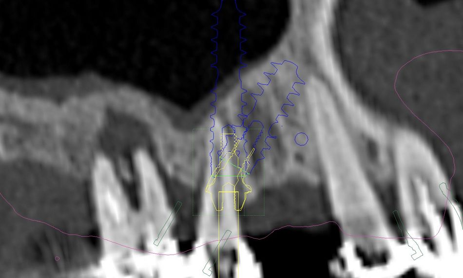 fig. 14