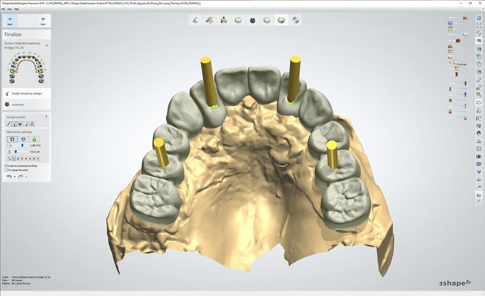 fig. 60