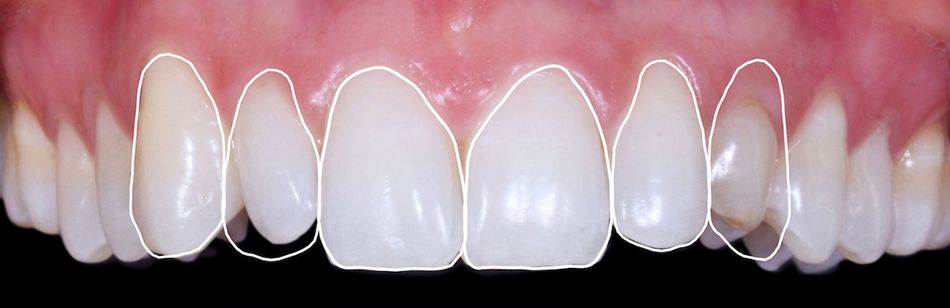 Fig. 15: Esthetic analysis.