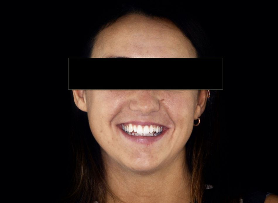 Fig. 1: View of the patient before the treatment.