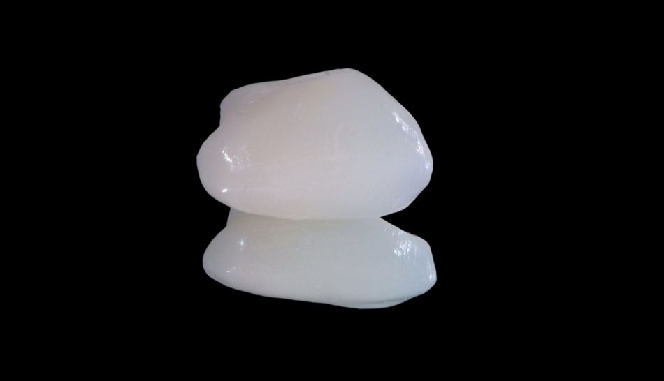 Fig. 23: Provisional crown.