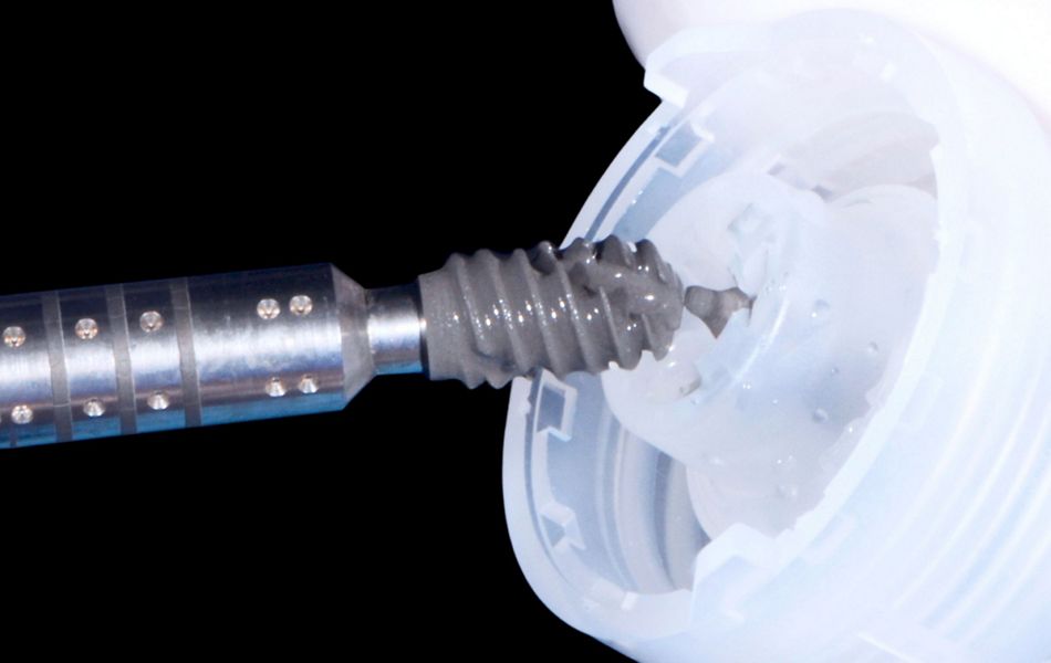 Fig. 36: A detail of the pickup of the implant: the pin placed in the apical part of the implant was gently broken.